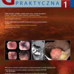 Tytuł: Gastroenterologia Praktyczna 1/2017
Autor: 
Wydawnictwo: Czelej
Formaty: EPUB