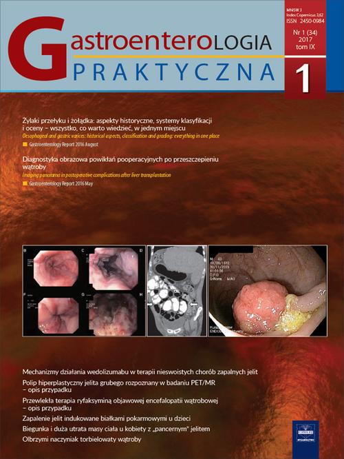 Tytuł: Gastroenterologia Praktyczna 1/2017
Autor: 
Wydawnictwo: Czelej
Formaty: EPUB