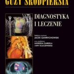 Guzy śródpiersia. Diagnostyka i leczenie — okładka e-booka