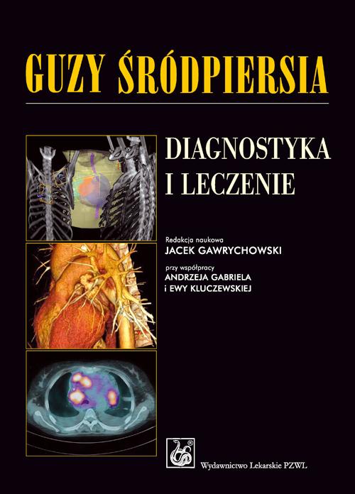 Guzy śródpiersia. Diagnostyka i leczenie — okładka e-booka