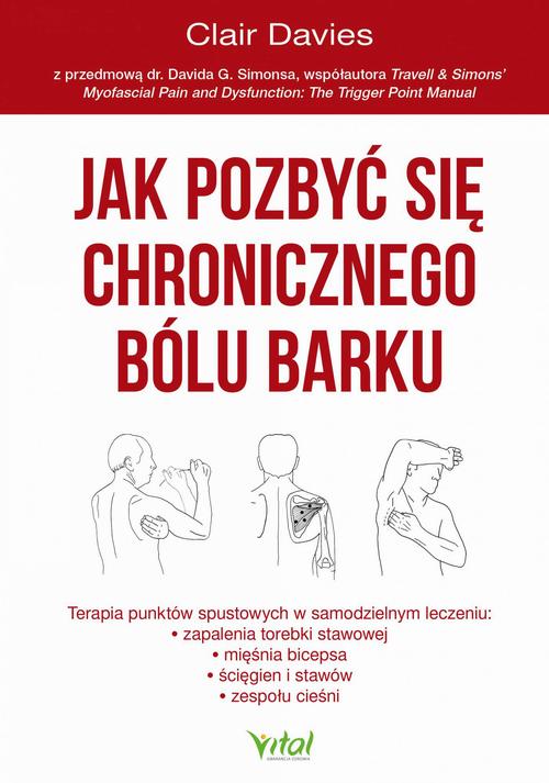 Jak pozbyć się chronicznego bólu barku. — okładka e-booka