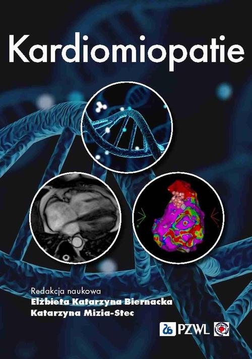Kardiomiopatie — okładka e-booka