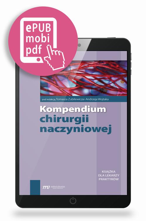 Tytuł: Kompendium chirurgii naczyniowej
Autor: Tomasz Zubilewicz, Andrzej Wojtak
Wydawnictwo: Medical Education
Formaty: PDF, EPUB, MOBI
