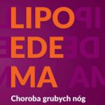 Lipoedema — okładka e-booka