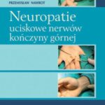 Neuropatie uciskowe nerwów kończyny górnej — okładka e-booka