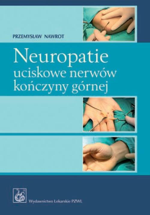 Neuropatie uciskowe nerwów kończyny górnej — okładka e-booka