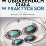 Postępowanie w obrażeniach ciała w praktyce SOR — okładka e-booka