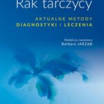 Rak tarczycy. Aktualne metody diagnostyki i leczenia — okładka e-booka