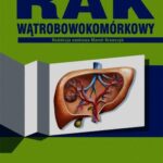 Rak wątrobowokomórkowy — okładka e-booka