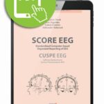 Tytuł: SCORE EEG Standardized Computer-based Organized Reporting of EEG. CUSPE EEG Cyfrowy Ujednolicony System Prezentowania EEG
Autor: Magdalena Bosak, Ewa Nagańska, Izabela Domitrz, Aleksander Sobieszek
Wydawnictwo: Medical Education
Formaty: PDF