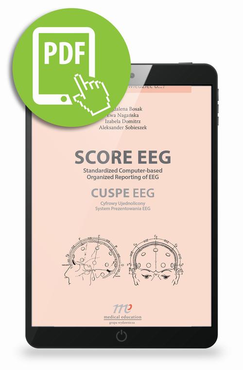 Tytuł: SCORE EEG Standardized Computer-based Organized Reporting of EEG. CUSPE EEG Cyfrowy Ujednolicony System Prezentowania EEG
Autor: Magdalena Bosak, Ewa Nagańska, Izabela Domitrz, Aleksander Sobieszek
Wydawnictwo: Medical Education
Formaty: PDF