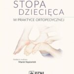 Stopa dziecięca w praktyce ortopedycznej — okładka e-booka