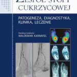 Tytuł: Zespół stopy cukrzycowej
Autor: Waldemar Karnafel
Wydawnictwo: PZWL
Formaty: EPUB, MOBI