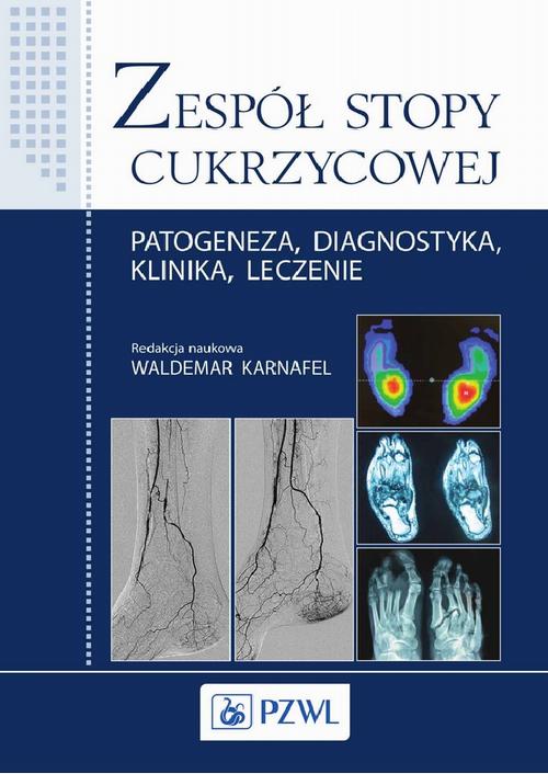 Tytuł: Zespół stopy cukrzycowej
Autor: Waldemar Karnafel
Wydawnictwo: PZWL
Formaty: EPUB, MOBI