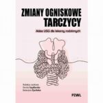 Tytuł: Zmiany ogniskowe tarczycy
Autor: 
Wydawnictwo: PZWL
Formaty: MOBI, EPUB