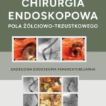 Chirurgia endoskopowa pola żółciowo-trzustkowego — okładka e-booka