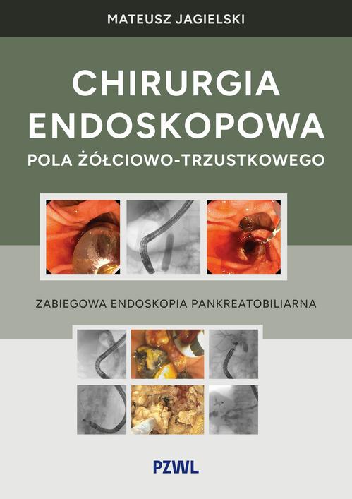 Chirurgia endoskopowa pola żółciowo-trzustkowego — okładka e-booka