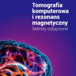 Tomografia komputerowa i rezonans magnetyczny — okładka e-booka